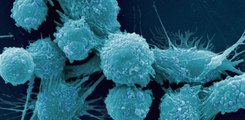 Des chercheurs découvrent comment les cellules cancéreuses se changent en tumeur