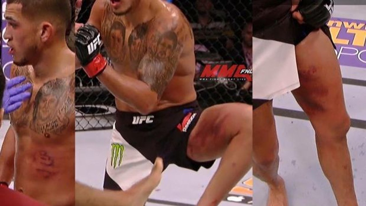 UFC 197: Edson Barbosa wird von Anthony Pettis stark verletzt