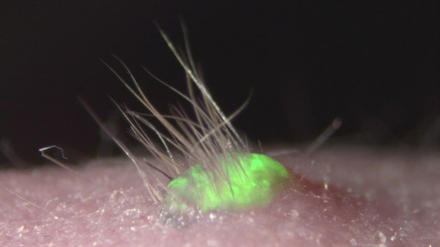 Des chercheurs créent de la peau artificielle qui peut faire pousser des poils et transpirer