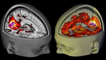 Les effets du LSD sur le cerveau observés pour la première fois