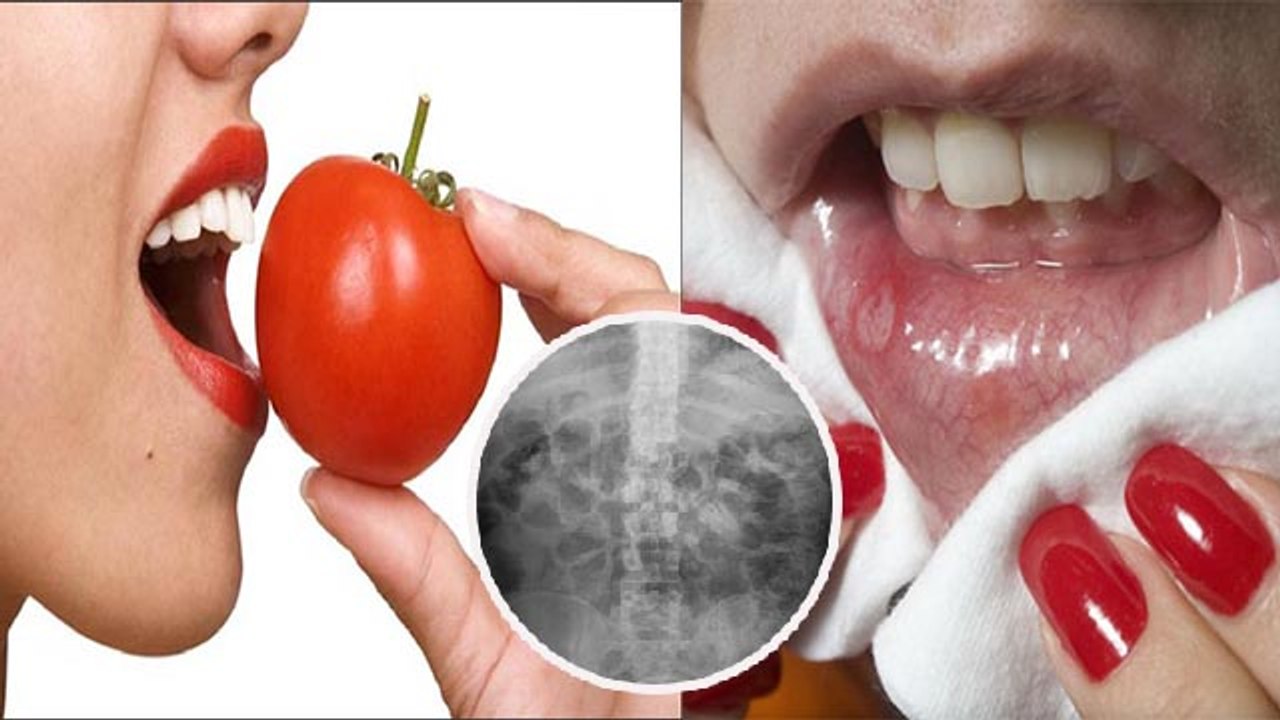 रोज 1 कच्चा टमाटर खाने से क्या होता है | Roz 1 Kaccha Tamatar Khane Se Kya Hota Hai | Boldsky