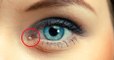 Qu'est-ce que ce petit angle rose au coin de l’œil ?