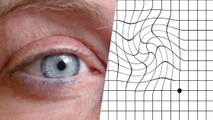 DMLA : cette maladie silencieuse peut vous faire perdre en partie la vue. Faites le test