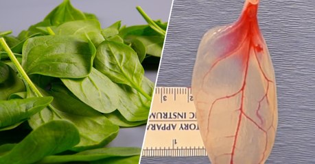 Des chercheurs transforment des feuilles d'épinard en tissu cardiaque humain