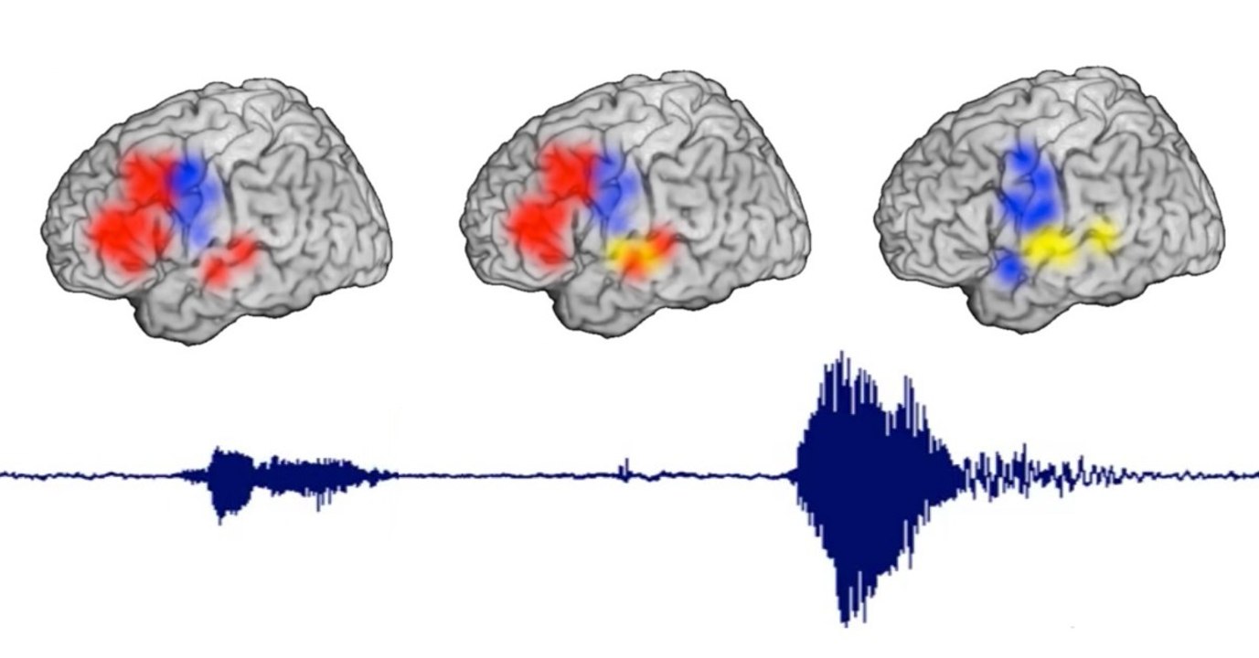 Des chercheurs ont suivi avec précision le cheminement d'une pensée dans le cerveau