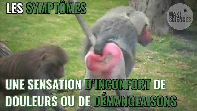 Hémorroïdes : traitement, symptômes, définition, comment soigner des hémorroïdes ?