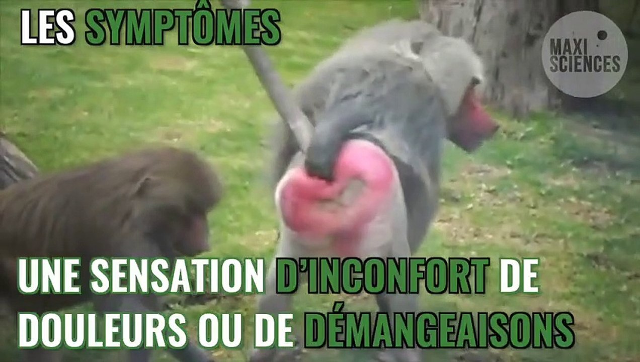 Hémorroïdes : traitement, symptômes, définition, comment soigner des hémorroïdes ?