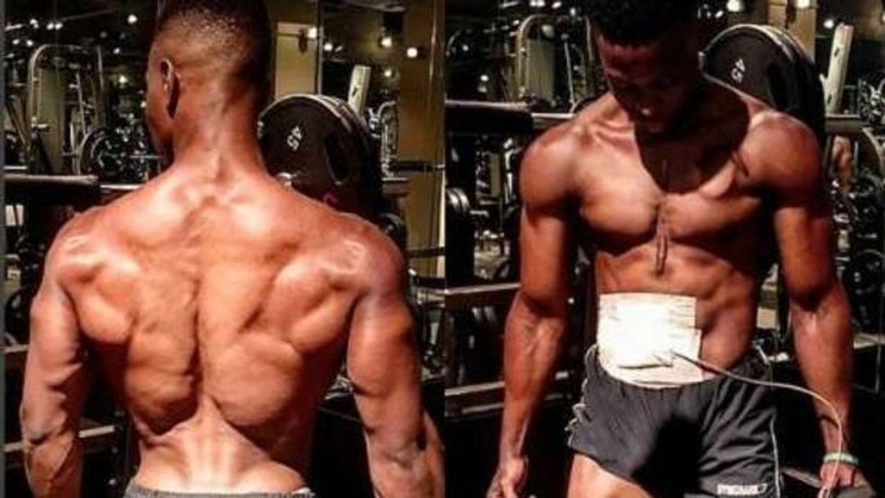 Andrew Jones: die unglaubliche Geschichte dieses Fitness-Models, das mit einem künstlichen Herzen lebt