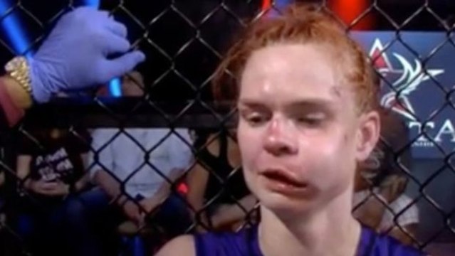 Peggy Morgan wird bei einem MMA-Kampf komplett deformiert