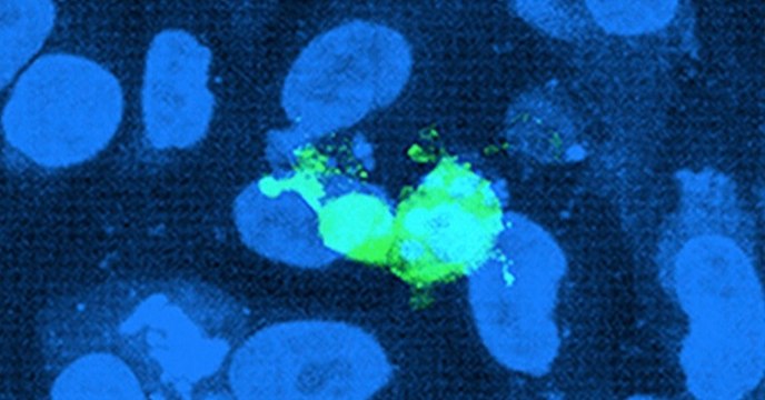 SIDA : une vidéo montre de façon inédite comment le VIH infecte des cellules