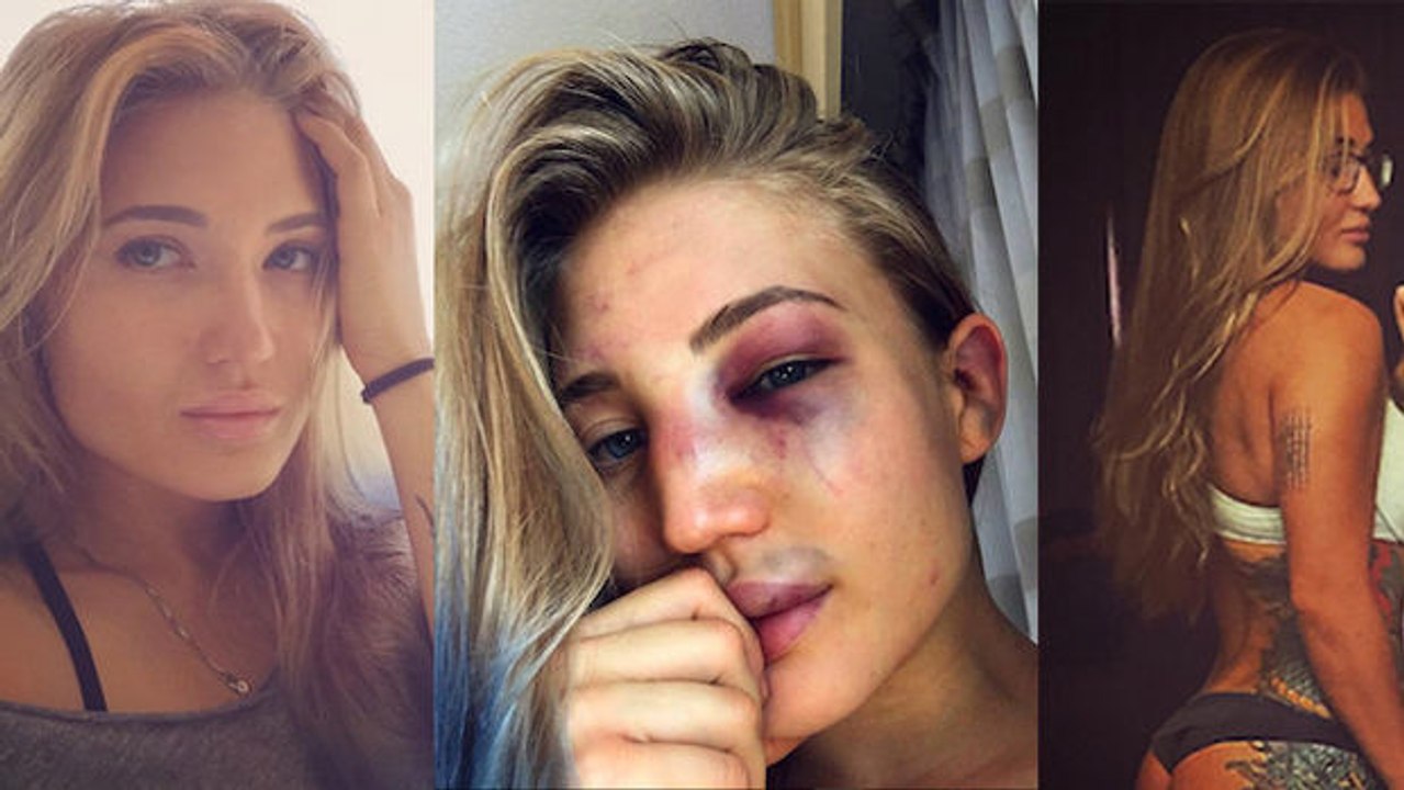 Anastasia Yankova zeigt ihr vom Kampf ramponiertes Gesicht