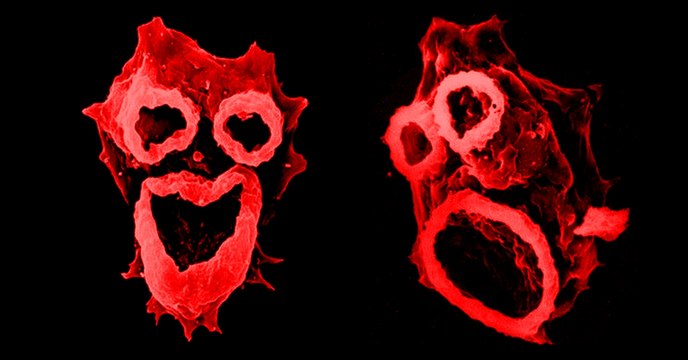 Des amibes dévoreuses de cerveau seraient en train de se répandre aux États-Unis