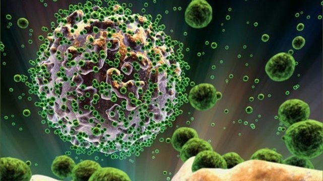 AIDS: Ein Engländer hat dank einer neuen Therapie die Chance, von HIV geheilt zu werden