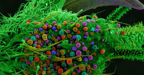 Cannabis : voilà à quoi ressemble la marijuana vue au microscope