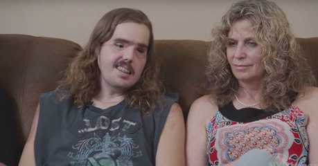 Découvrez la greffe de visage la plus sophistiquée jamais réalisée jusqu’à présent