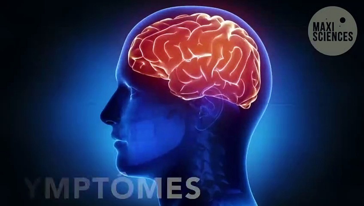 Alzheimer : des parties du cerveau se modifient avant l'arrivée des premiers symptômes