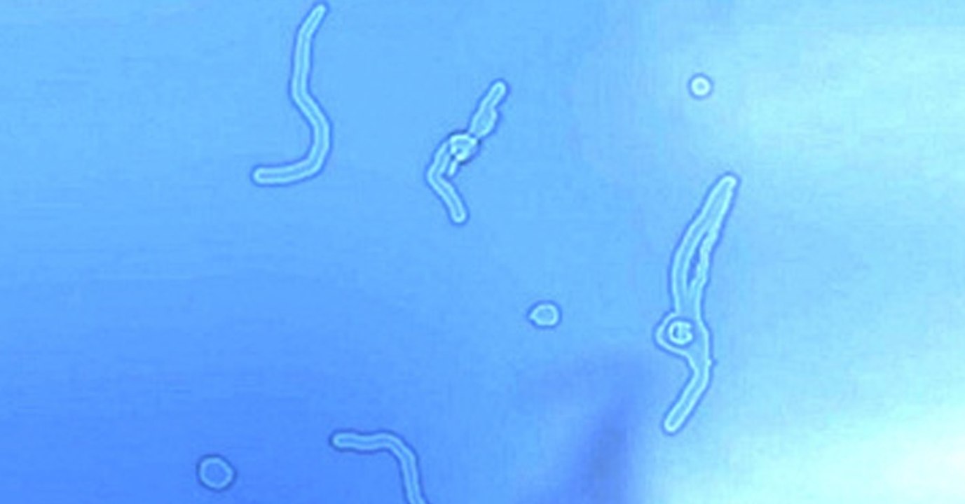 Siehst du solche leuchtenden Fäden? Dann solltest du das wissen