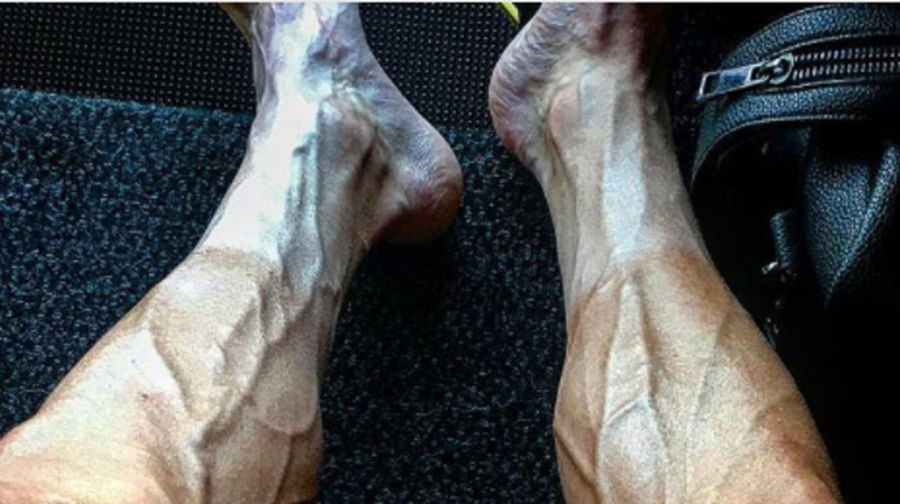 Tour de France: Radprofi schockiert mit Horror-Beinen