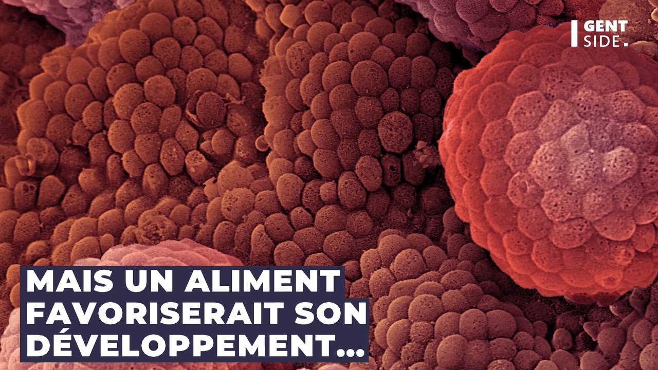 Santé : cet aliment pourrait favoriser le cancer de la prostate