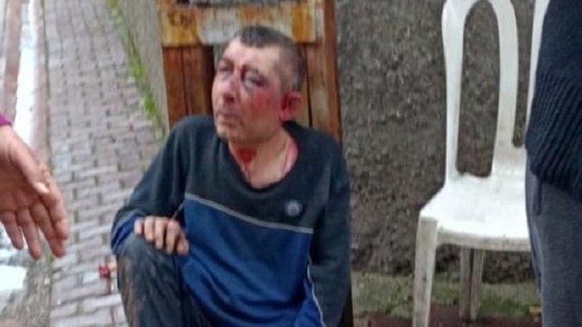 Fırın işçisini öldüresiye dövüp evinin önüne bıraktılar