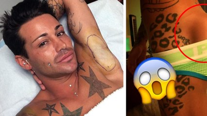 Cet homme dépense des milliers pour avoir les fesses parfaites, le résultat est... étonnant