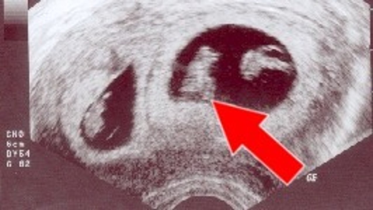 Cette mère de triplés voulait absolument une petit fille... Mais jamais elle ne s'attendait à ce qui lui est arrivé !