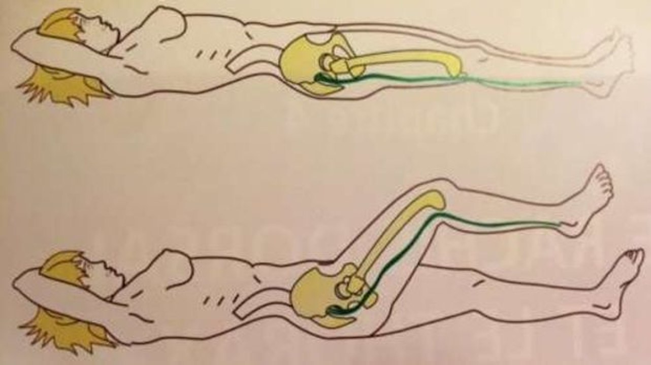 Schnelle Hilfe bei Ischias-Schmerzen