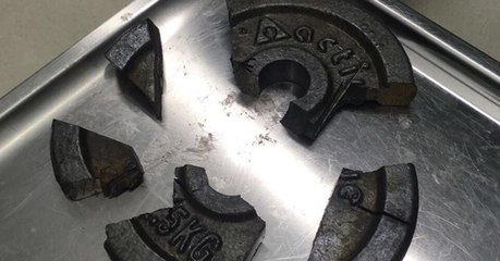 Mann klemmt sensibelstes Körperteil in Hantel ein: Die Folgen sind nicht auzumachen!