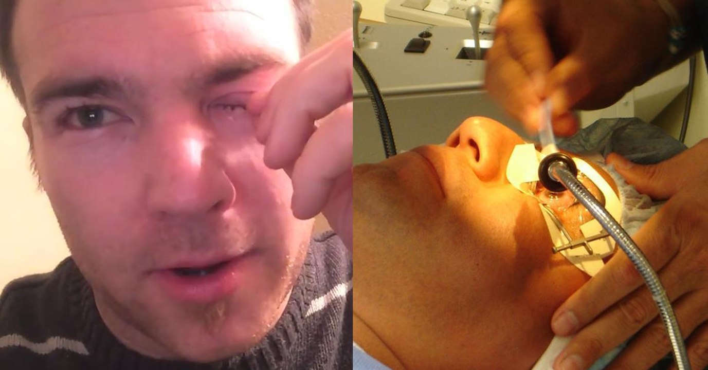Mann klagt über Juckreiz: Dann findet sein Arzt etwas Unglaubliches in seinem Auge!
