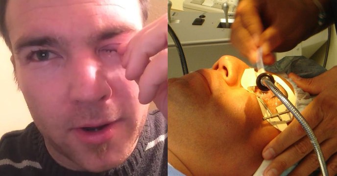 Mann klagt über Juckreiz: Dann findet sein Arzt etwas Unglaubliches in seinem Auge!