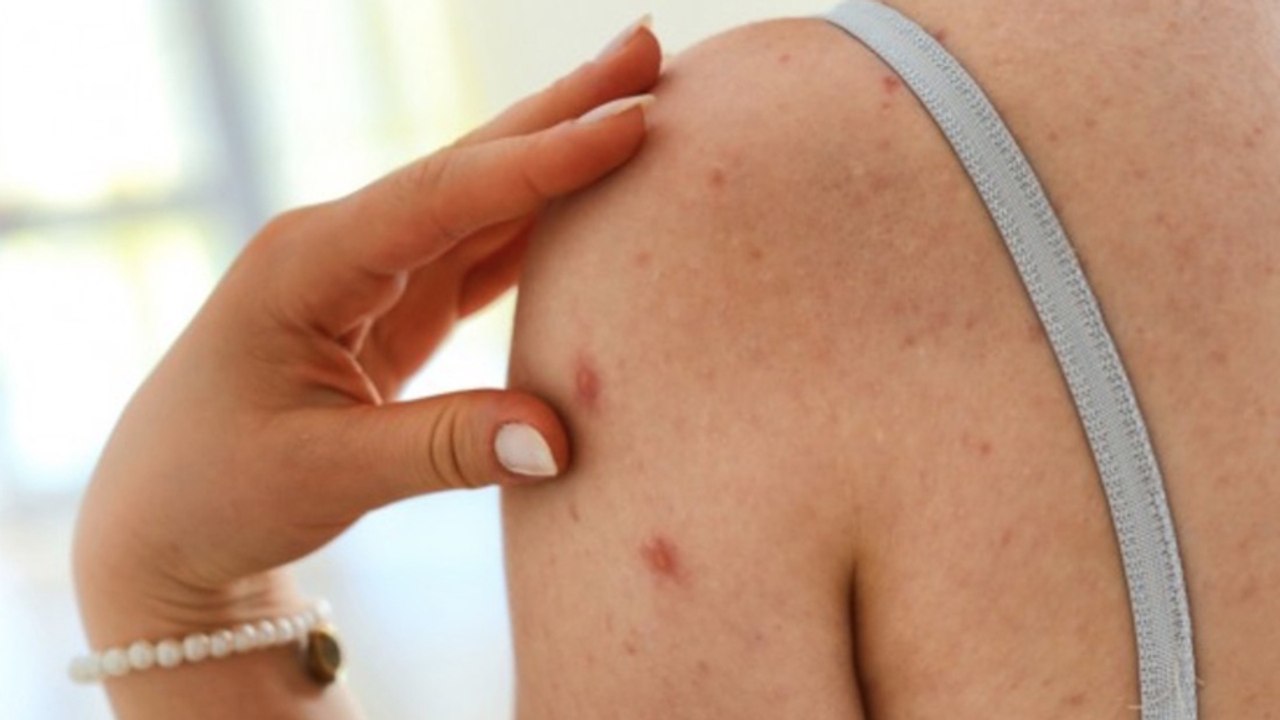 Uni Dresden warnt: Studentin könnte Epidemie ausgelöst haben