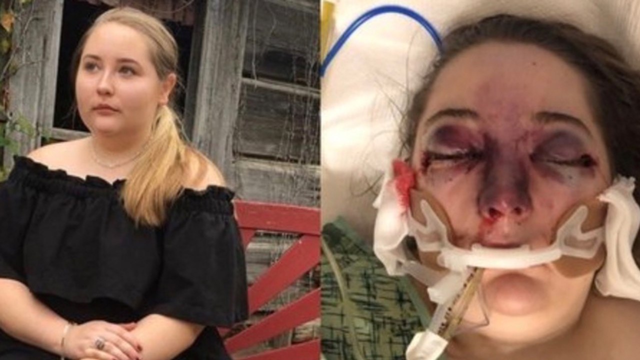 Teenager erkrankt myteriös nach kreuzschifffahrt