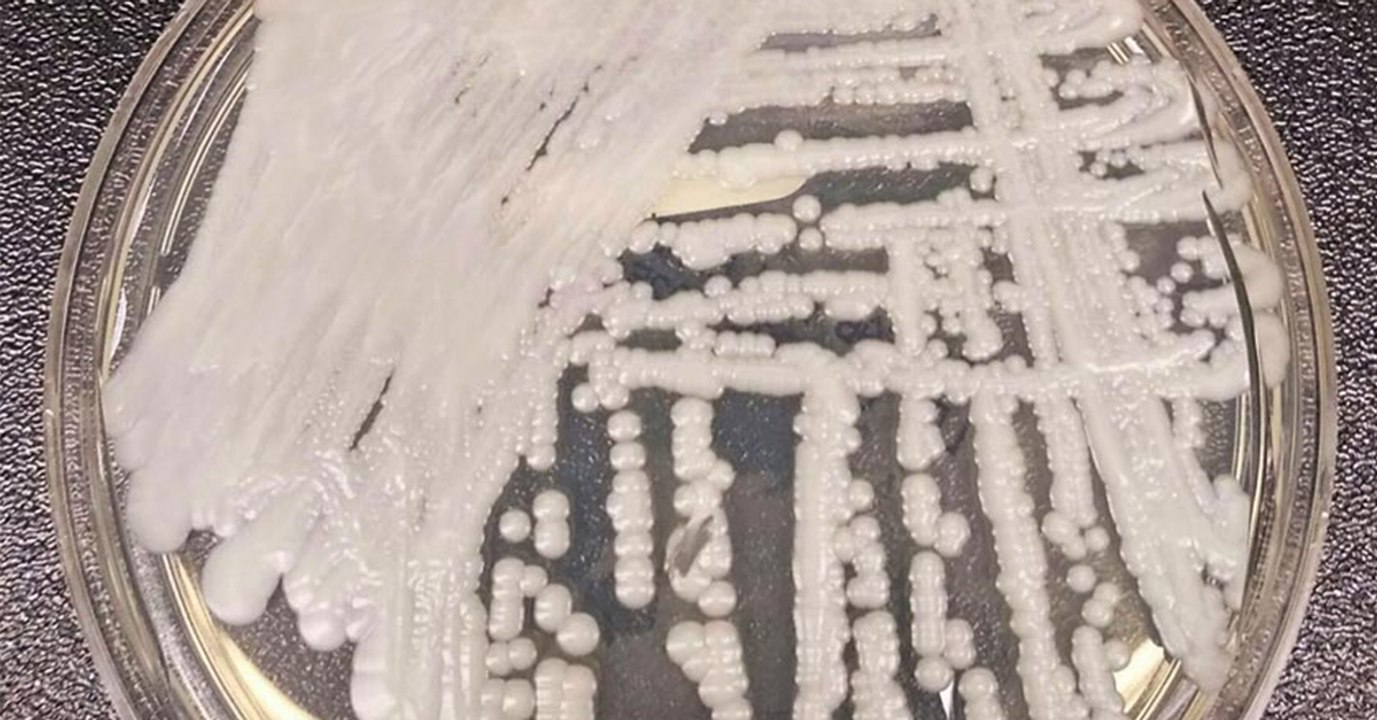 Killerpilz greift international um sich und lässt sich nicht heilen: Das solltet ihr unbedingt machen!