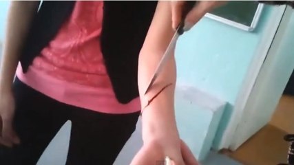 Une prof découpe le bras de son élève pour un cours de chimie