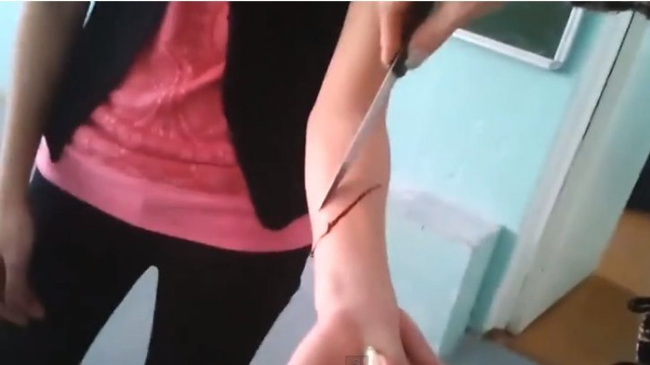 Une prof découpe le bras de son élève pour un cours de chimie