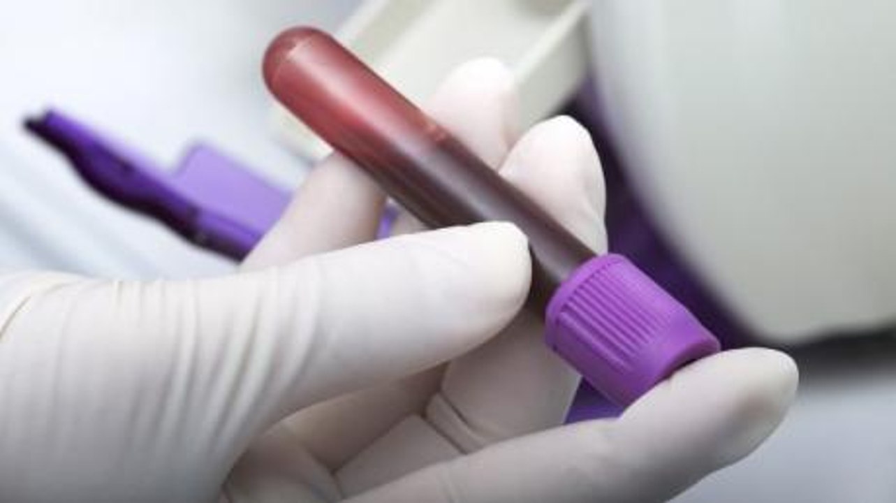 Menschen mit 'goldenem Blut' können Millionen von Leben retten