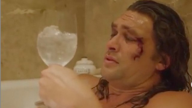 Game of Thrones -Star setzt seine Fäuste gegen Plastik ein und holt sich dabei ein blaues Auge
