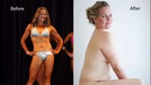 Cette femme a décidé de partager son expérience afin d'aider les autres à assumer leur corps. Son témoignage est incroyable