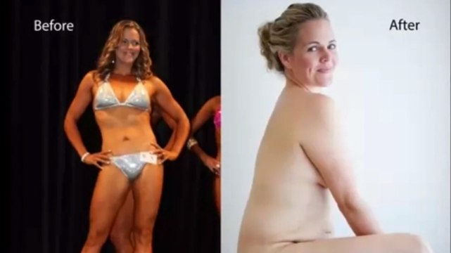 Cette femme a décidé de partager son expérience afin d'aider les autres à assumer leur corps. Son témoignage est incroyable