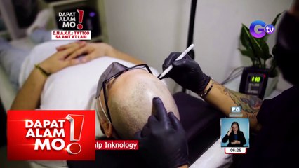 Dapat Alam Mo!: Micropigmentation, sagot sa tumataas na hairline?
