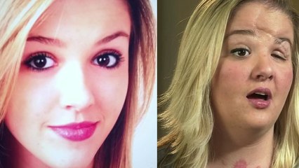 Cette jeune fille a hérité d'un destin tragique. Son histoire va vous bouleverser