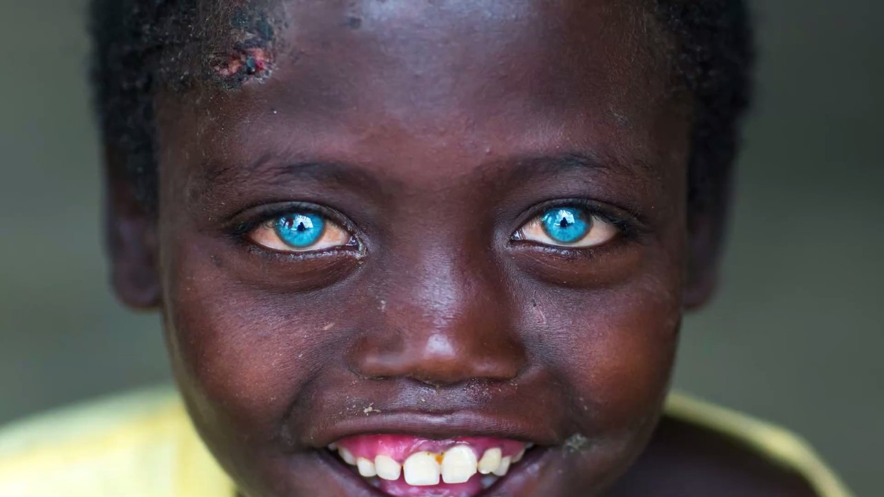 Knallblaue augen nach genmutation bei indonesischen ureinwohnern