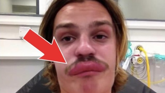 Ce mec a été piqué par un insecte. Mais il ne s'attendait pas à ce qui lui est arrivé ensuite