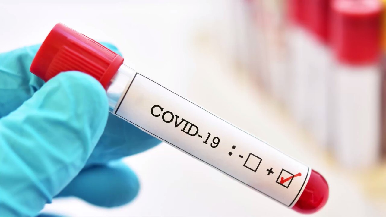 Covid-19: Rekord-Infektionen in der Premier League