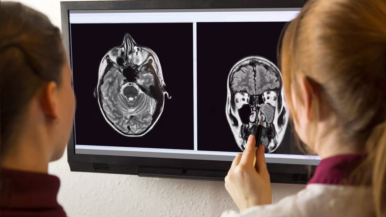 Beim Schnäuzen dringt ekelhafter Geruch aus Nase eines Jugendlichen: Jahre später entdecken Ärzte den Grund