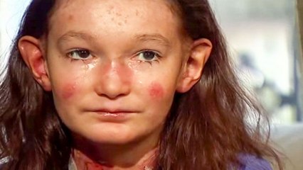 Cette petite fille souffre d'une rare maladie de peau. Elle a reçu le plus beau soutien qui soit