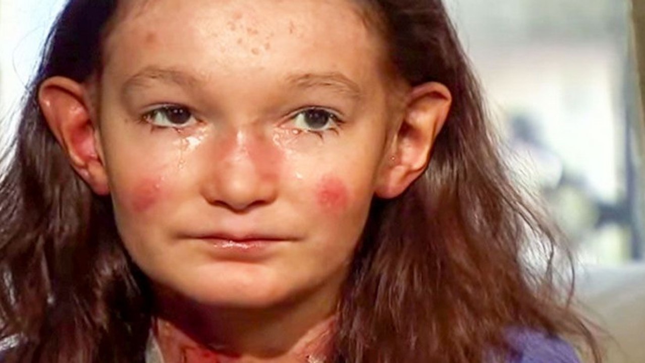 Cette petite fille souffre d'une rare maladie de peau. Elle a reçu le plus beau soutien qui soit