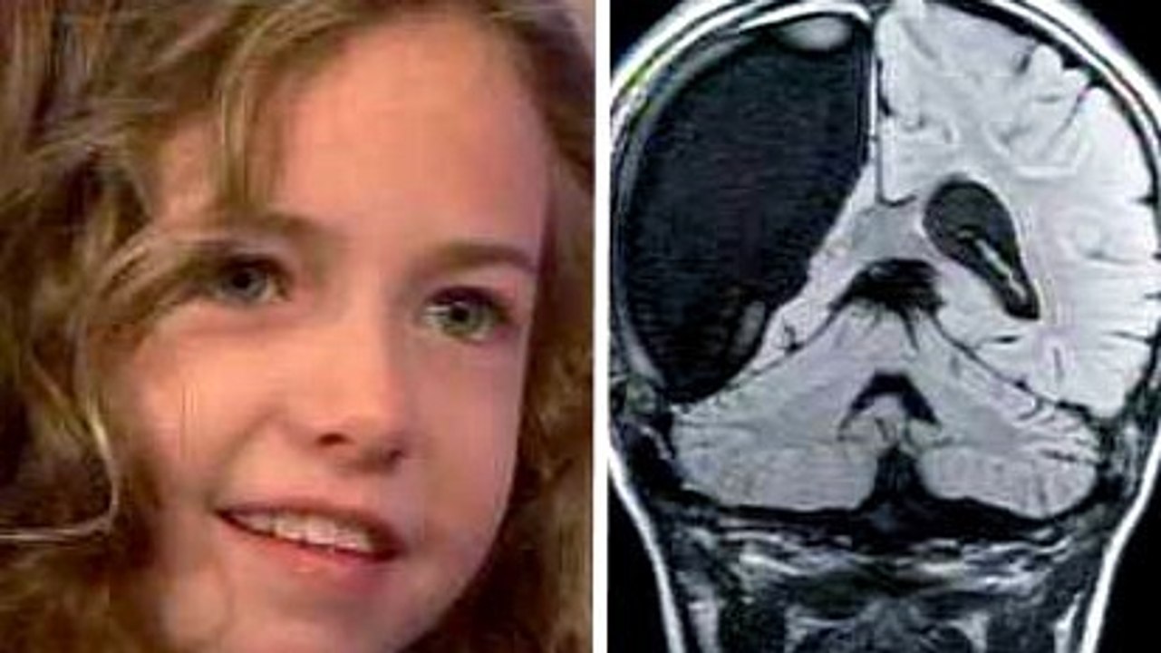 Cette petite fille souffrait d'une maladie très rare. Ce que ses parents ont osé faire est très courageux