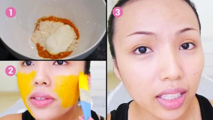 Ce masque est miraculeux contre l'acné. A essayer d'urgence !