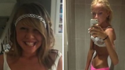 Cette jeune fille a commencé un régime pour ressembler à Miranda Kerr. Mais la suite de son histoire est tragique